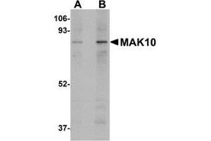 Western Blotting (WB) image for anti-MAK10 Homolog, Amino-Acid N-Acetyltransferase Subunit (MAK10) (Middle Region) antibody (ABIN1030993) (MAK10/NAA35 抗体  (Middle Region))