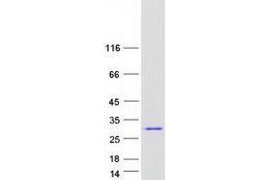 Zinc Finger and SCAN Domain Containing 31 (ZSCAN31) (Transcript Variant 1) protein (Myc-DYKDDDDK Tag)