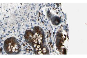 ABIN6269192 at 1/100 staining Mouse intestine tissue by IHC-P. (CBL 抗体  (Internal Region))
