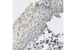 Immunohistochemistry of paraffin-embedded human esophagus using GBF1 antibody at dilution of 1:100 (x40 lens). (GBF1 抗体)