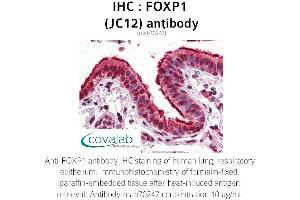Image no. 1 for anti-Forkhead Box P1 (FOXP1) antibody (ABIN5693578) (FOXP1 抗体)