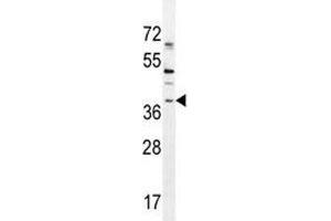 SOX1 antibody western blot analysis in NCI-H460 lysate. (SOX1 抗体  (AA 47-76))