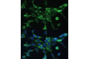 Immunofluorescence analysis of NIH-3T3 cells using COX6 Polyclonal Antibody (ABIN6132108, ABIN6138915, ABIN6138916 and ABIN6220368) at dilution of 1:100 (40x lens). (COX6A1 抗体  (AA 25-109))
