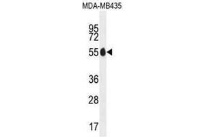 PAX1 Antibody (N-term) western blot analysis in MDA-MB435 cell line lysates (35µg/lane). (PAX1 抗体  (N-Term))