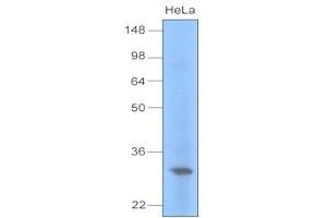 Cell lysates of HeLa (30 ug) were resolved by SDS-PAGE, transferred to PVDF membrane and probed with anti-human UNG (1:1000). (UNG 抗体  (AA 1-313))
