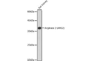 Western blot analysis of extracts of Rat kidney, using Arginase 2  antibody (ABIN6131236, ABIN6137078, ABIN6137079 and ABIN6221969) at 1:1000 dilution. (ARG2 抗体  (AA 1-354))