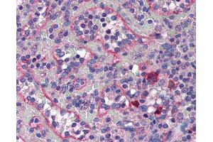Anti-COPB2 antibody IHC of human spleen. (COPB2 抗体  (AA 494-511))