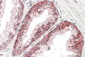 ABIN185626 (3. (CTNNA1 抗体  (Internal Region))