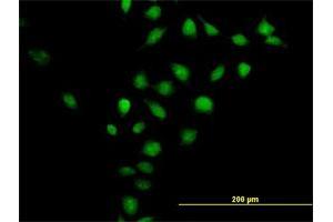 Immunofluorescence of purified MaxPab antibody to CNNM3 on HeLa cell. (Cyclin M3 抗体  (AA 1-355))
