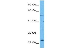 Host:  Rabbit  Target Name:  CACNG1  Sample Tissue:  Human Lung Tumor  Antibody Dilution:  1ug/ml