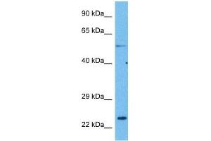 Host:  Rabbit  Target Name:  CACNG1  Sample Tissue:  Human Lung Tumor  Antibody Dilution:  1ug/ml (CACNG1 抗体  (N-Term))