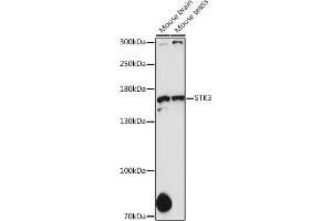 Western blot analysis of extracts of various cell lines, using STK36 antibody (ABIN6135016, ABIN6148614, ABIN6148615 and ABIN7101365) at 1:1000 dilution. (STK36 抗体  (AA 250-450))