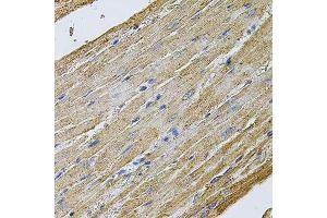 Immunohistochemistry of paraffin-embedded rat heart using CDH16 antibody. (Cadherin-16 抗体  (AA 19-230))