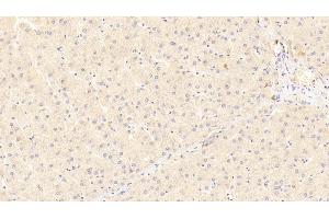 Detection of LRP5 in Human Liver Tissue using Polyclonal Antibody to Low Density Lipoprotein Receptor Related Protein 5 (LRP5) (LRP5 抗体  (AA 769-1016))