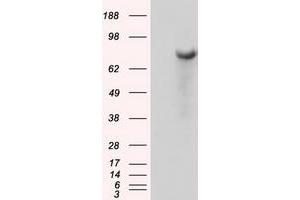 Image no. 4 for anti-Bruton Agammaglobulinemia tyrosine Kinase (BTK) antibody (ABIN1496972) (BTK 抗体)