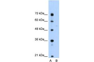 WB Suggested Anti-SLA Antibody Titration:  0. (SLA 抗体  (N-Term))