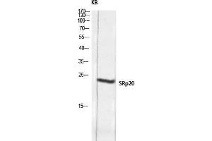 Western Blot (WB) analysis of KB lysis using SRp20 antibody. (SRSF3 抗体  (C-Term))