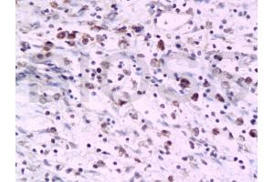 Formalin-fixed and paraffin embedded rat colon tissue labeled with Anti-PTAFR Polyclonal Antibody, Unconjugated (ABIN687127) at 1:200 followed by conjugation to the secondary antibody and DAB staining (PTAFR 抗体  (AA 231-342))