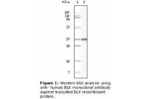 Image no. 2 for anti-B Lymphoid Tyrosine Kinase (BLK) antibody (ABIN232111) (BLK 抗体)