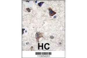 Image no. 2 for anti-Cadherin 4 (CDH4) (AA 182-211), (N-Term) antibody (ABIN356865) (Cadherin 4 抗体  (N-Term))