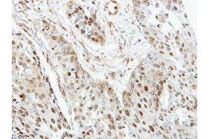 IHC-P Image Immunohistochemical analysis of paraffin-embedded human Trachea, using RanGAP1, antibody at 1:100 dilution. (RANGAP1 抗体  (N-Term))