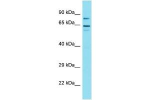 Western Blotting (WB) image for anti-Golgin A6 Family-Like 1 (GOLGA6L1) (N-Term) antibody (ABIN2791557) (GOLGA6L1 抗体  (N-Term))