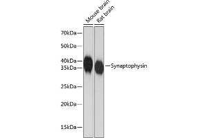 Western blot analysis of extracts of various cell lines, using Synaptophysin antibody (ABIN7270669) at 1:1000 dilution.