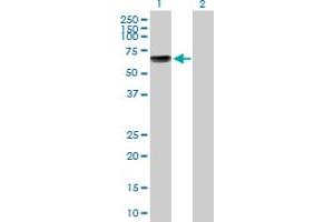 Western Blotting (WB) image for anti-Potassium Voltage-Gated Channel, Shaker-Related Subfamily, Member 1 (KCNA1) (AA 1-495) antibody (ABIN517305)