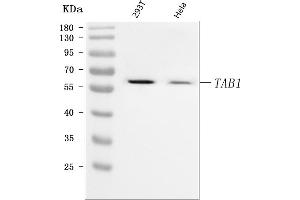 Western blot analysis of TAB1 using anti-TAB1 antibody (ABIN7601880).
