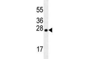 LXN antibody western blot analysis in mouse brain tissue lysate. (Latexin 抗体)