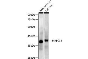 Western blot analysis of extracts of various cell lines, using MRPS31 antibody (ABIN7268585) at 1:1000 dilution. (MRPS31 抗体)