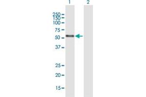 Western Blot analysis of NR2C1 expression in transfected 293T cell line by NR2C1 MaxPab polyclonal antibody. (NR2C1 抗体  (AA 1-467))