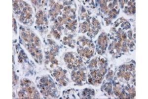Immunohistochemistry (IHC) image for anti-Bruton Agammaglobulinemia tyrosine Kinase (BTK) antibody (ABIN1496972) (BTK 抗体)