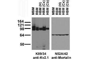 Immunoblots on brain membranes prepared from whole rat (RBM) and mouse (MBM) brain, and from human hippocampus [HBM(H)], cerebral cortex [HBM(Cx)] and cerebellum [HBM(Cb)].
