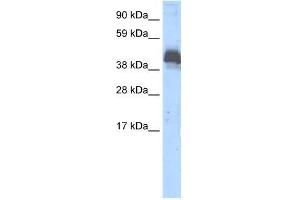 Human Thymus; WB Suggested Anti-ZNF297B Antibody Titration: 0. (ZBTB43 抗体  (Middle Region))