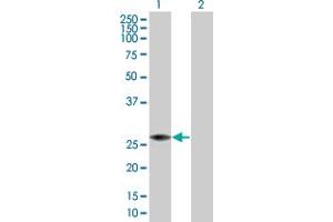Western Blot analysis of PRDX4 expression in transfected 293T cell line by PRDX4 MaxPab polyclonal antibody. (Peroxiredoxin 4 抗体  (AA 1-271))