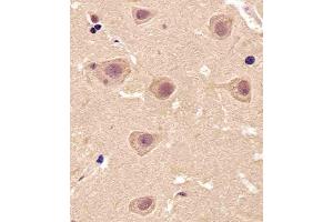 Paraformaldehyde-fixed, paraffin embedded Human brain tissue, Antigen retrieval by boiling in sodium citrate buffer (pH6. (PIN1 抗体)