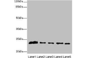 Western blot All lanes: MMD2 antibody at 3 μg/mL Lane 1: Mouse brain tissue Lane 2: Mouse kidney tissue Lane 3: U251 whole cell lysate Lane 4: 293T whole cell lysate Lane 5: Mouse liver tissue Secondary Goat polyclonal to rabbit IgG at 1/10000 dilution Predicted band size: 32, 29, 23 kDa Observed band size: 23 kDa (MMD2 抗体  (AA 1-38))