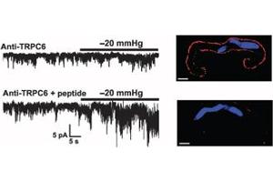 TRPC6 is required for stretch activation in myocytes.