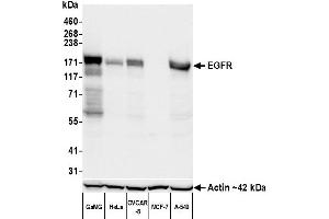 Western Blotting (WB) image for anti-Epidermal Growth Factor Receptor (EGFR) (AA 1100-1150) antibody (ABIN7795640)