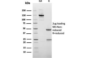 SDS-PAGE Analysis of Purified Cytokeratin 10 Mouse Recombinant Monoclonal Antibody (rKRT10/1275). (Recombinant Keratin 10 抗体)