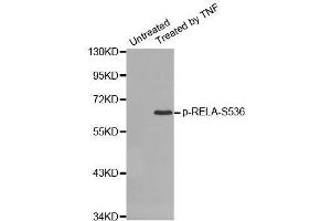Western blot analysis of extracts from HepG2 cells using Phospho-RELA-S536 antibody (ABIN2987368). (NF-kB p65 抗体  (pSer536))