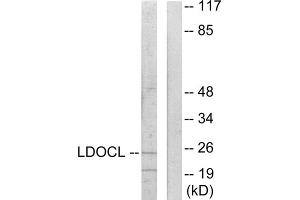 Western blot analysis of extracts from COLO205 cells, using LDOCL antibody. (LDOC1L 抗体  (Internal Region))