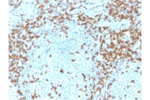 Formalin-fixed, paraffin-embedded human Tonsil stained with CD5-Monospecific Mouse Monoclonal Antibody (CD5/2418).