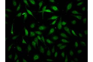 Immunofluorescence staining of Hela Cells with ABIN7127474 at 1:50, counter-stained with DAPI. (Recombinant ErbB2/Her2 抗体)