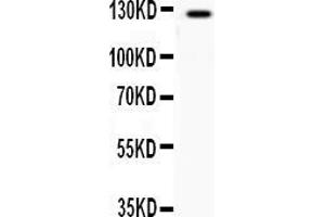 Western blot analysis of AFF44 expression in COLO320 whole cell lysates ( Lane 1). (AFF4 抗体  (N-Term))