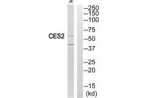 Western Blotting (WB) image for anti-Carboxylesterase 2 (CES2) (Internal Region) antibody (ABIN1851018) (CES2 抗体  (Internal Region))