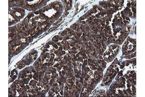 Image no. 4 for anti-Armadillo Repeat Containing 1 (ARMC1) antibody (ABIN1496724)