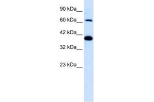 Western Blotting (WB) image for anti-Glutamate Receptor, Ionotropic, Kainate 2 (GRIK2) antibody (ABIN2461162) (GRIK2 抗体)