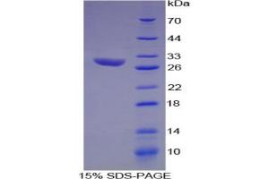 SDS-PAGE analysis of Rat Hydroxyacid Oxidase 1 Protein. (HAO1 蛋白)